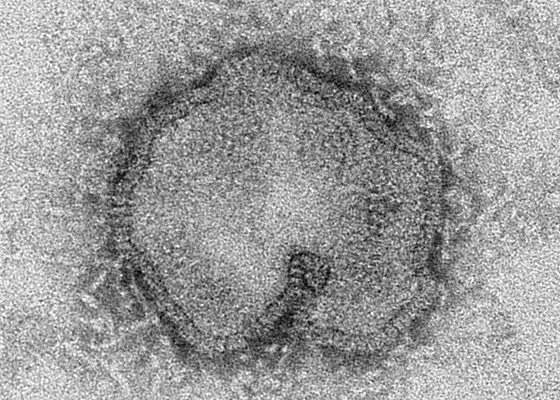 Virus H7N9 patí podle WHO k nejsmrtelnjím svého druhu.