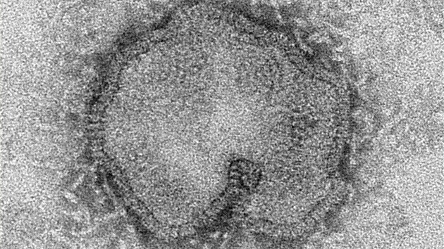 Virus H7N9 pat podle WHO k nejsmrtelnjm svho druhu.