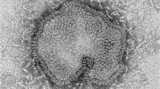 Virus H7N9 dsí odborníky vysokou úmrtností. Nevyluují, e práv on by mohl vyvolat celosvtovou epidemii.