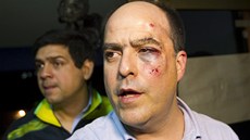 Jedním ze zranných poslanc je opoziní zákonodárce Julio Borges