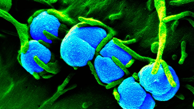 Bakterie zpsobujc kapavku pod mikroskopem