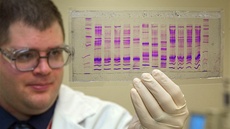 Bez analýzy DNA si uz expertizy nedovedeme představit. Bez analýzy DNA si uz expertizy nedovedeme představit.