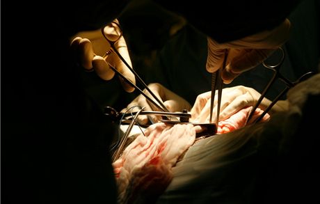 Japonský výzkum me být revolucí v oboru transplantací. Ilustraní snímek