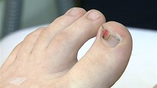 Podiatr Jaroslav Fešar zdobí rovnátka obrázky. Podiatr Jaroslav Fešar zdobí rovnátka obrázky.