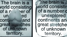 Vlevo je myí mozek v bném stavu, vpravo oetený rozpoutdlem podle metody...