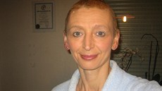 Během chemoterapie přišla paní Alena o vlasy, časem jí ale narostly nové. Během chemoterapie přišla paní Alena o vlasy, časem jí ale narostly nové.