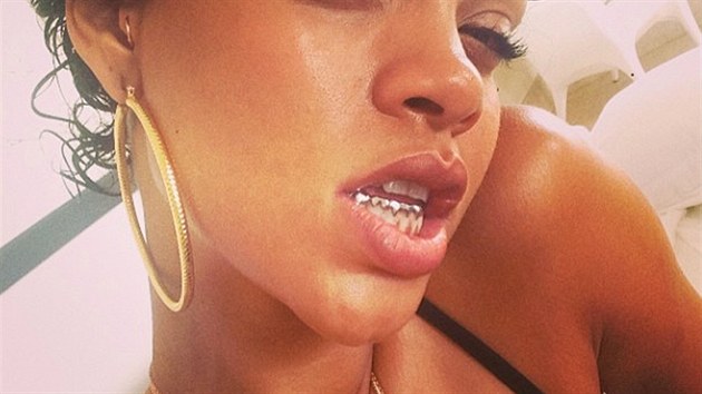 Rihanna a jej zlat zuby
