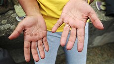 Starosta Jirkova Radek Štejnar říká, že lidem, kteří se do problémů nedostali... Starosta Jirkova Radek Štejnar říká, že lidem, kteří se do problémů nedostali...