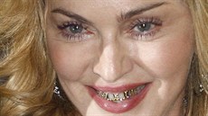 Zlaté doplky na zuby jsou te u hvzd populární.