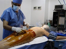 Personál pipravuje pacientku na vyoperování silikonu.
