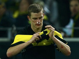 Záloník Sven Bender z Borussie Dortmund dohrál zápas Ligy mistr se zlomeným...