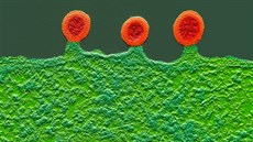 Buňka infikovaná virem HIV. Dodatečně obarvený snímek z elektronového... Buňka infikovaná virem HIV. Dodatečně obarvený snímek z elektronového...