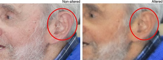 Na snímku vpravo je vidt ucho Fidela Castra s drátkem nasluchátka, vlevo...
