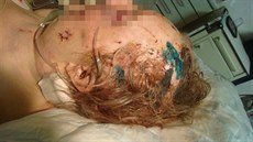 Napadená seniorka utrpěla vážná zranění Napadená seniorka utrpěla vážná zranění