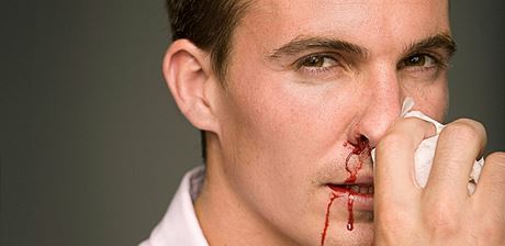 I obyejné krvácení z nosu je pro hemofilika nebezpené.