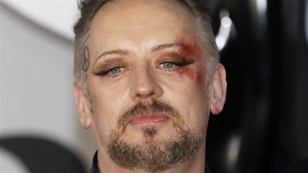 Jsem ob mdy, vysvtloval svou rnu na levm oku Boy George.