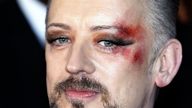 Boy George si nechal na oku udlat umlou rnu jako mdn doplnk.