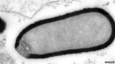 Třicet tisíc let starý vir znovu ožil v laboratoři. Třicet tisíc let starý vir znovu ožil v laboratoři.