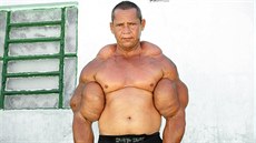Brazilec Arlindo de Souza má nejvtí bicepsy, není to ovem díky cviení.