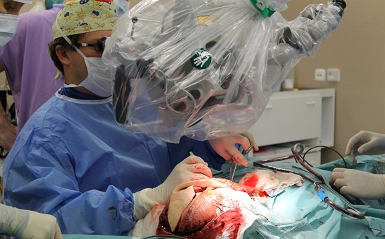 Zlínským lékam s operací nádoru na lebce pomohl plastický chirurg Tomá...