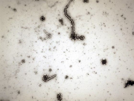 Virus ebola pod mikroskopem
