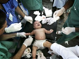 DÍT OBTÍ. Palestintí doktoi operují miminko, které bylo zranno pi potyce...