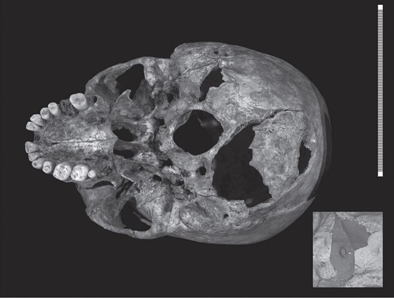 Snímek lebky Richarda III. ukazuje smrtelná zranní, která rozporuplný monarcha...