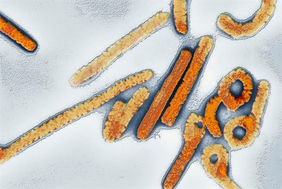 Virus marburg zpsobuje krvácivou horeku. Úmrtnost nakaených je 90 procent.