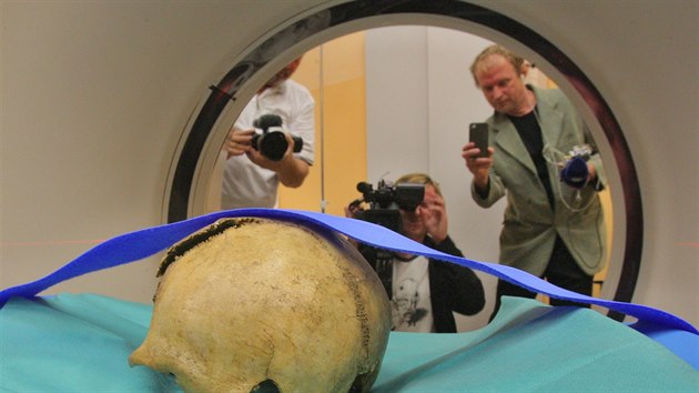 Tborsk nemocnice vytvoila pomoc potaov tomografie prostorov snmek ostatk lebky, kter mohla patit Janu ikovi z Trocnova.