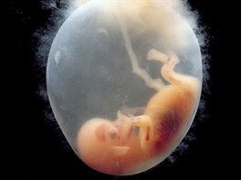 Embryo v desátém týdnu, kdy ji lze rozeznat konetiny. V tle plodu jsou...