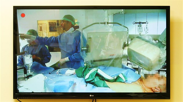 Karlovarsk kardiocentrum penelo online operaci vnitch tepen.