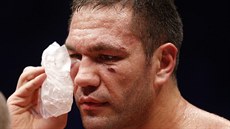 Bulharský boxer Pulev má po KO od Vladimíra Klika zlomenou lícní kost a otes...