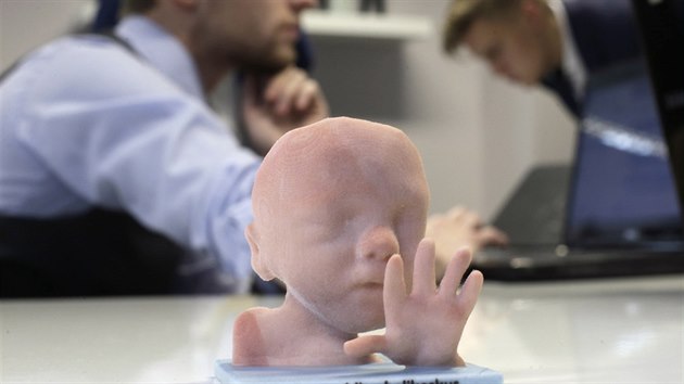 Firma Wolfprint 3D na zklad ultrazvukovho snmku vyrb trojrozmrn modely nenarozench dt (31. ledna 2015).