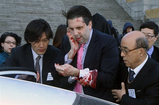 Americký velvyslanec v Jiní Koreji Mark Lippert míí do nemocnice poté, co ho...