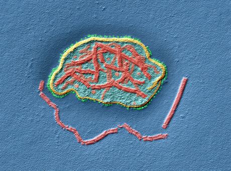 Virus spalniek pod elektronovým mikroskopem (TEM)