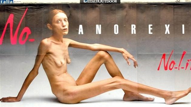 V Miln se objevily okujc billboardy s vyhublou modelkou Isabelle Caro, kter trp anorexi.