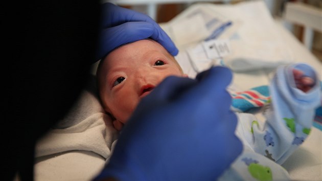 Mal Eli se narodil se vzcnou vrozenou vadou nazvanou kompletn arrhinie (19. bezna 2015)