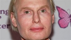 Fred Brandt vypadal jako bizarní Peter Pan. Na tomto snímku mu bylo... Fred Brandt vypadal jako bizarní Peter Pan. Na tomto snímku mu bylo...