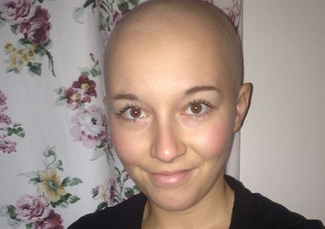 Po léb chemoterapií jsem pila o vlasy a doufám, e mj boj s rakovinou...