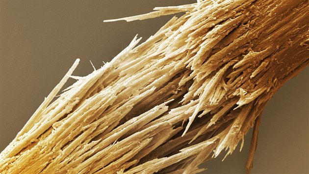 Pokud byste si prohldli pokozen vlas pod mikroskopem, dostali byste tento obrzek. Kehk, such vlasy ponien tepelnou a chemickou pravou ztrcej pevnost i prunost.