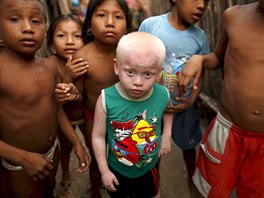 Kipigaliler Harris, 5, who is part of the albino or "Children of the Moon"...