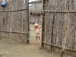 Iveily Morales, 3, who is part of the albino or "Children of the Moon" group...