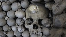 Tahle lebka vojáka nese hluboký šrám, pravděpodobně od úderu šavlí. Lidé věří,... Tahle lebka vojáka nese hluboký šrám, pravděpodobně od úderu šavlí. Lidé věří,...