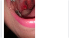 CDS nebo MMS je ve skupině věnované těmto přípravkům pochopitelně odpovědí na jakýkoli neduh, se kterým zoufalí pacienti do této zoufalé internetové sociální ordinace přijdou.