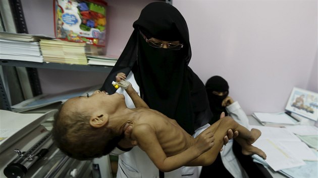 Zdravotn sestra v hlavnm mst Jemenu San s podvyivenm dttem v nru (28. ervence 2015)
