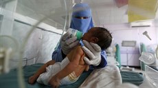 Zdravotní sestra krmí dít narozené v jemenské metropoli Saná. (30. ervence...