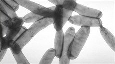 Bakterie legionella pneumophila Bakterie legionella pneumophila