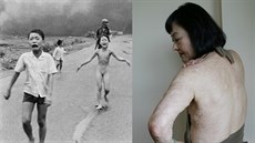 Vietnamka Kim Phuc, jejíž snímek, na kterém je zachycena jako utíkající nahá... Vietnamka Kim Phuc, jejíž snímek, na kterém je zachycena jako utíkající nahá...