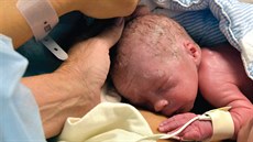 Prvním díttem narozeným po transplantaci dlohy byl chlapec Vincent, který se...