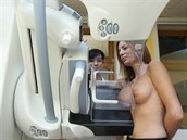 Olomouck fakultn nemocnice pedstavila nov modern mamograf, kter je v...